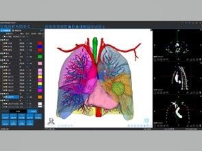 Medical 3D reconstruction and 3D printing services
